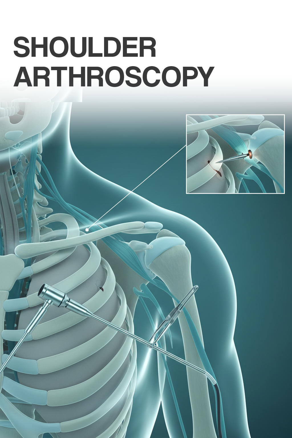 Arthroscopy