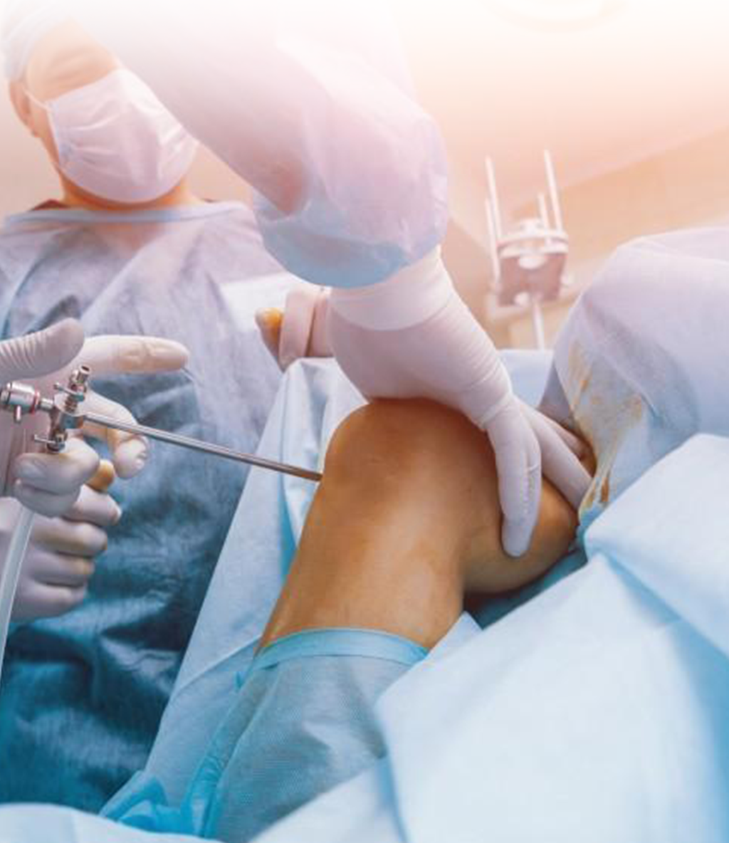 Robotic Knee Replacement