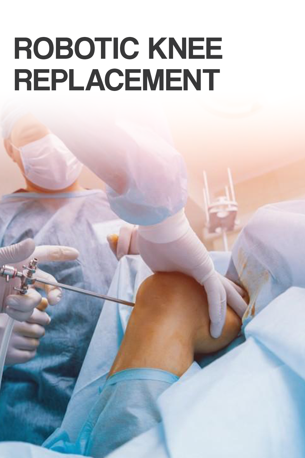 Robotic Knee Replacement